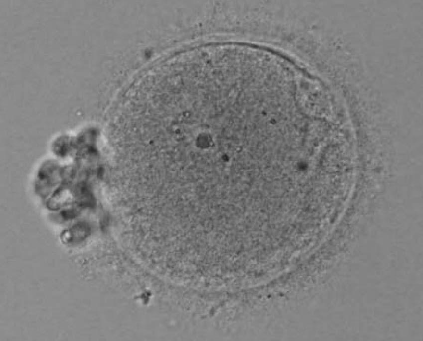 4 cell & 8 cell embryos.