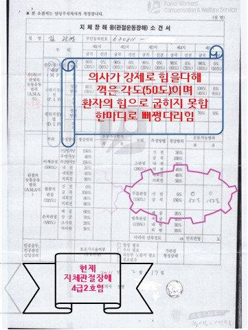 중앙산재병원의문제