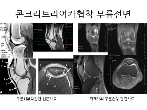 근로복지공단 29