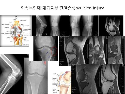 근로복지공단 34