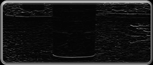 ( 경계검출 )] D = (H/h) x d 도입효과 [