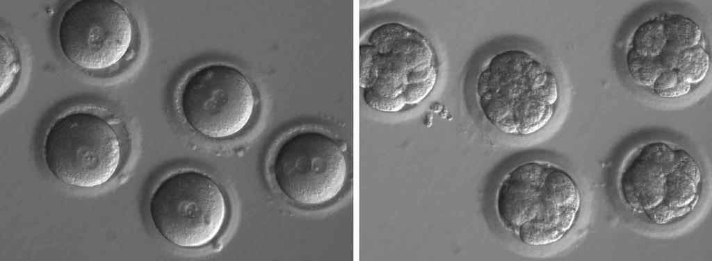 Newly fertilized eggs before gene editing, left, and embryos after gene editing and a few rounds of cell division.