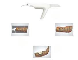 따라서 Dental System 은광범위한적응증을지원하는생산적인디자인을위한업계최고의