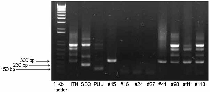 전남지역설치류의한탄바이러스감염 209 Figure 1. Agarose gel electophoresis of RT-PCR products for the detection of Hantaan virus of the wild rodents trapped in Jeollanam-do.