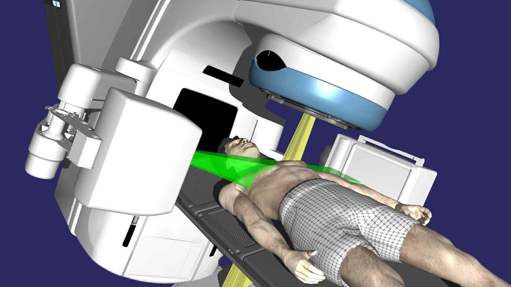 Board Imager device] [Varian 사의 On Board Imager device animation still] 선영상진단한계극복을위한융 복합의료기기개발 è 시장니즈 는양전자방출촬영기 와컴퓨터단층촬영기 를융합한기기임 의해부학적영상과