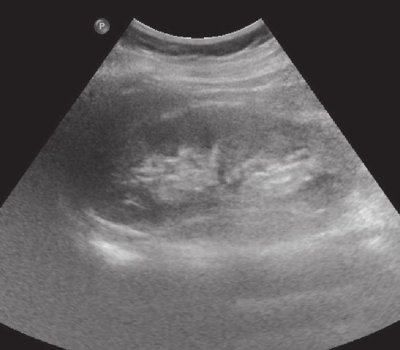 3. 비뇨의학과외래참관술기 신장초음파 Renal Ultrasonography - 신장은요추의양측, 후복막강내에좌우대칭으로존재한다.