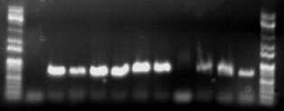 PCR 산물을 Sequencing