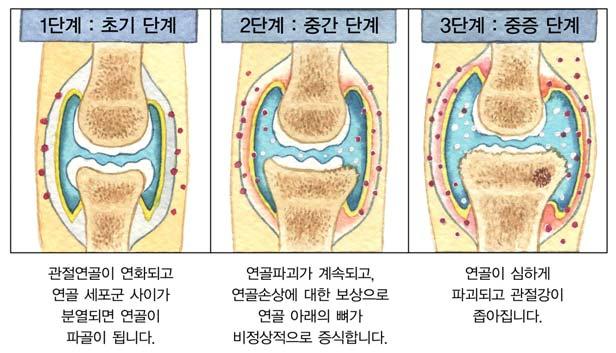 모양이변형된다 ( 그림 Ⅰ-2).