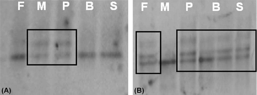 (B) There are SNPs in exon 16 of, P, B and S. Abbreviations :, father; M, mother; P, patient; B, brother; S, sister Australia) 결과도음성이었다.