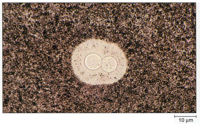 , (capsule stain). ( 3.16). (India ink)...,.. (Bacillus) (Clostridum) (endospore).