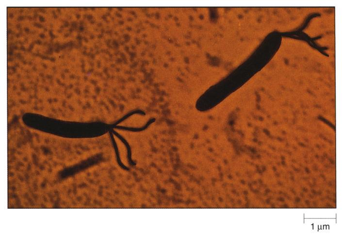 집의 일부 혹은 표면에 특정 단백질을 갖는 세포들만을 관찰 할 수도 있다(그림 3.19). 편모염색 편모(flagella)는 원핵세포에서 가장 보편적인 운동기작을 제공 형광염색제 하는 세포부속물이나, 보통 너무 얇아서 광학현미경으로는 보 어떤 형광염색제들은 모든 세포들에서 발견되는 화합물에 결 이지 않는다.