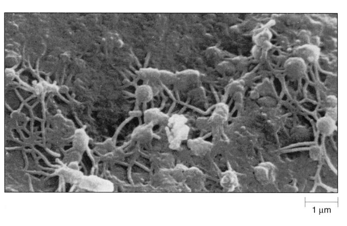 7 캡슐과 점질층은 미생물들이 표면에 부착이 가능하게 하며 때로는 우리 캡슐(당질피질) 몸의 선천적인 방어체계로부터 세균을 보호하기도 한다. capsule(glycocalyx) 캡슐과 점질층은 어떻게 다른가? 치태란 무엇인가?