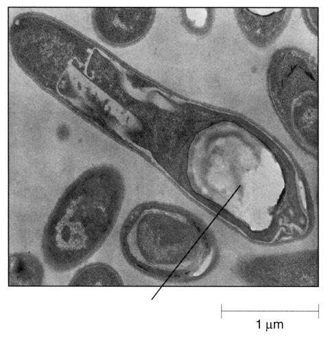 Clostridium tetani, Clostridium perfringens Bacillus anthracis.