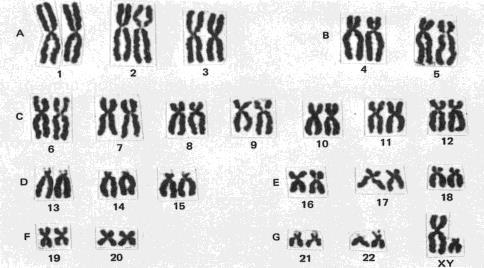 DN, 유전자, 염색체 07 그림은 DN 의일반적인 구조를나타낸것이다. 이에 대한설명으로옳지않은것은? 1 는염기쌍이며수소결합으로묶여있다. 2 는당과인산골격이다. 3 DN는 2중 나선 구조를 가진다. 4 DN 는인산, 6 탄당, 염기를포함한다. 5 DN 의기본구성단위는뉴클레오타이드이다. 08 다음중유전자에대한설명으로옳은것은?