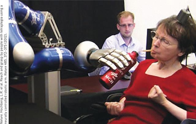 로봇팔 미국브라운대학교의뇌연구자들 (2012) 은뇌졸중 (stoke) 환자캐시의운동피질에