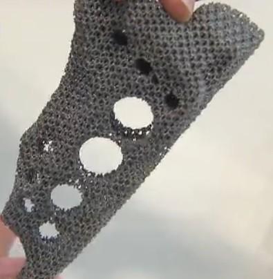 세몽골소년 네르구이 에게 3D 프린팅기술을이용하여맞춤형기도지지체를제작함 환자맞춤형비강통로용특수스텐스를 3D