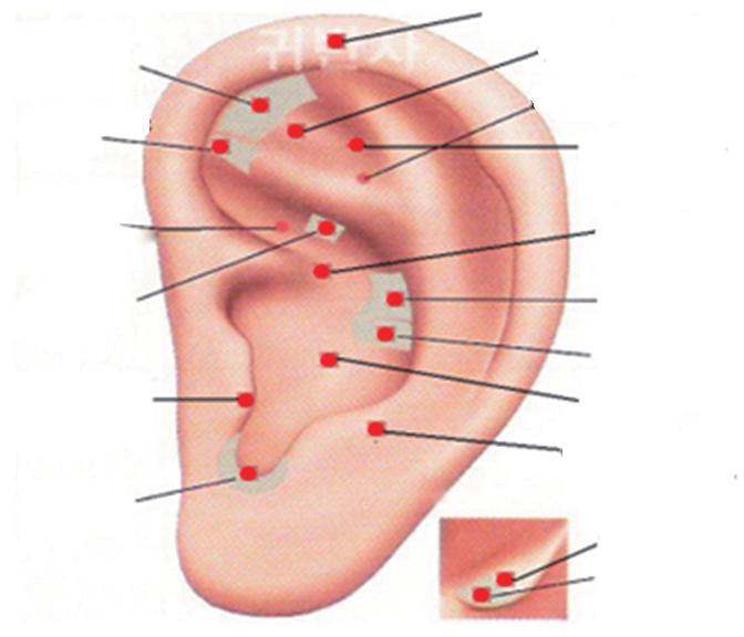 귀반사요법이여자대학생들의월경통, 일상생활장애, 부정적인정서및자율신경계반응에미치는효과 161 uterus sympathetic center of superior concha kidney adrenal gland endocrine ear apex adnexa pelvic cavity shenmen/ sinmoon stomach liver spleen