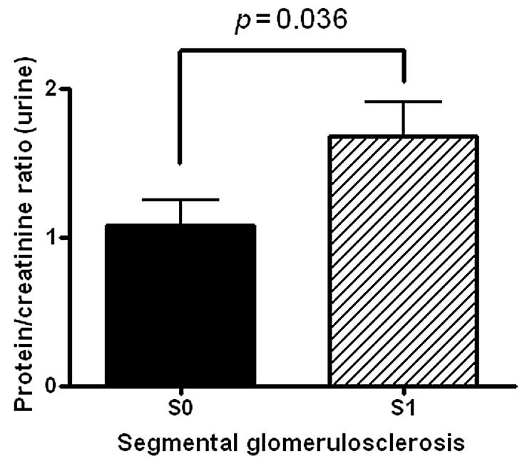 (B) Segmental glomerulosclerosis. (C) Endocapillary hypercellularity. (D) Tubular atrophy/interstitial fibrosis.