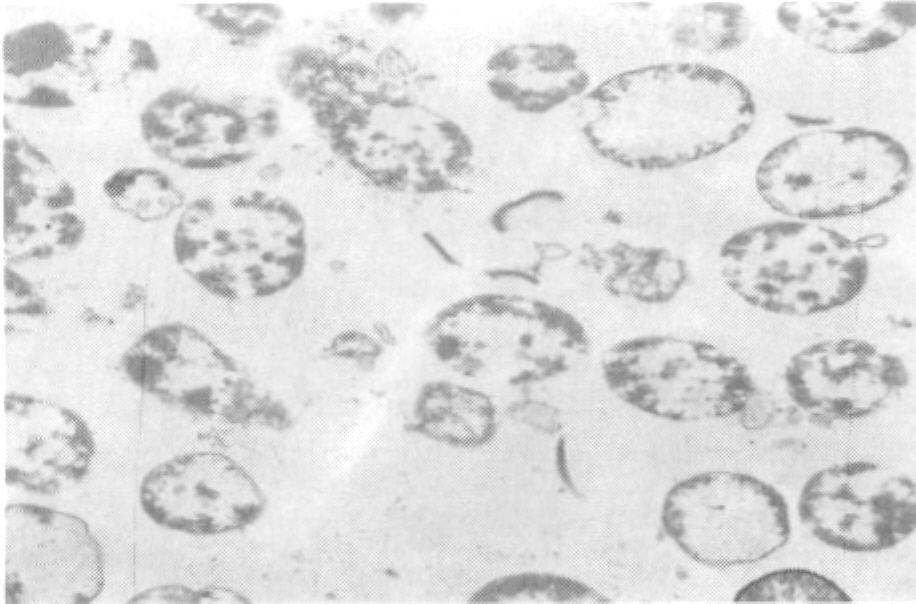 coli BHR-12 A: Normal cells (Control) B,