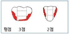 구강위생검사 ( 구강환경관리능력지수, PHP 지수 ) 구강환경관리능력을측정하는지표로상악우측제1대구치 ( 협 ), 상악우측중절치 ( 순 ), 상악좌측제1대구치 ( 협 ), 하악좌측제1대구치 ( 설 ), 하악좌측중절치 ( 순 ), 하악우측제1대구치 ( 설 ) 치면에세균막이부착된정도를조사하며구강환경관리능력지수를구하는절차는다음과같다.