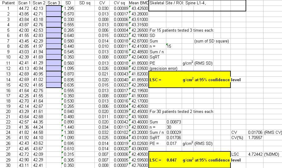 C 병원 QUS/ B UA 의인체내정밀도측정 : 1. 7 1 % (C V ) D 병원 QUS 2 종은 B UA 결과가없는기종임. 표 4.