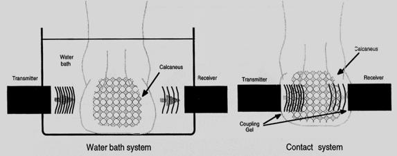 1.3 국내 외기술개발현황 1. 3. 1 국외연구동향 (1) 정량적초음파 (QUS) 의원리초음파의성질은반사 (reflection) 와투과 (transmission) 로측정된다. 그림 1과같이두개의 transducer(sending/ receiving) 를측정물체의양쪽에위치시키고측정한다.