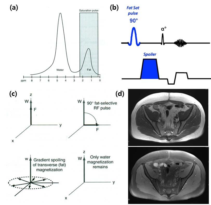 Figure 2. Principles of the fat saturation mechanism.