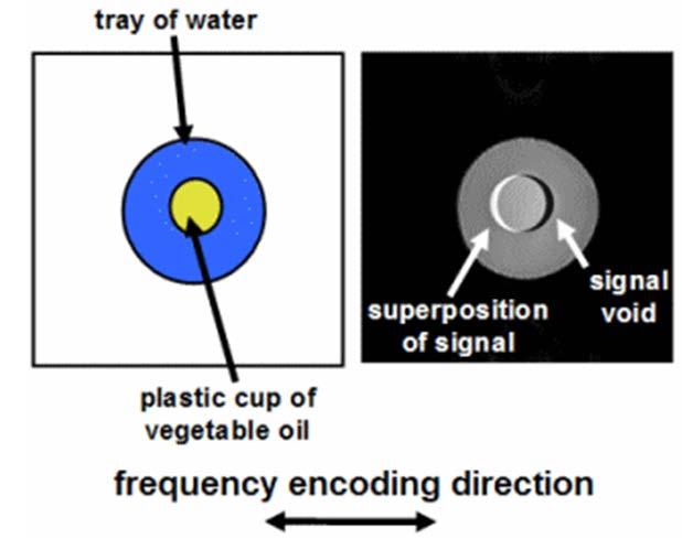 Adapted from http://mriquestions.com/fat-sat-pulses. html. interaction을통해 free water proton에전달이되면서 Free water 신호의감소를초래한다 (Figure 4).