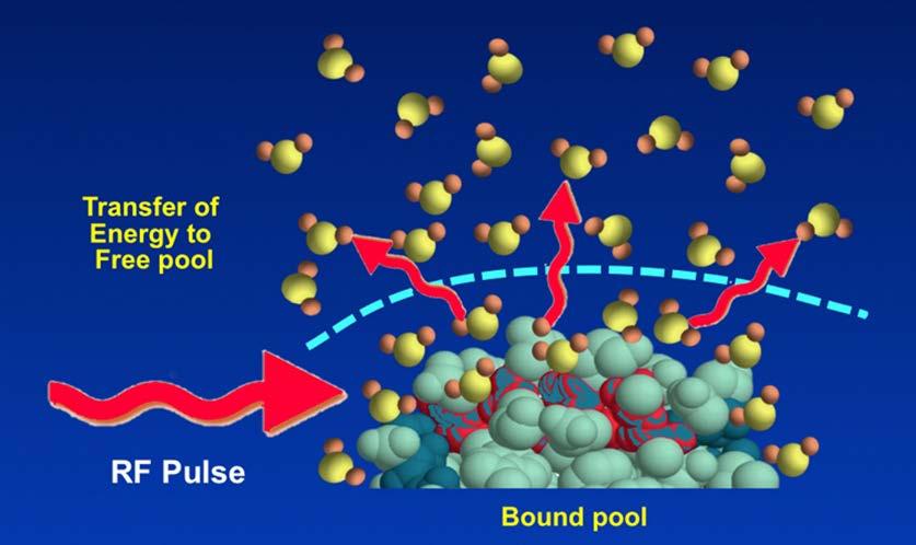 A specially designed RF pulse (called an MT Pulse) is applied which selectively injects energy into the bound pool of protons (macromolecules and bound water).