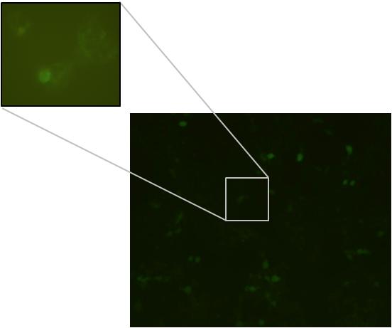 그림 2.1-4. 현미경을통한 293T 세포에서의 GFP 발현.