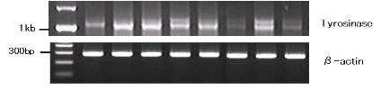 ( 나) Tyrosinase 발현억제효과 5가지유기용매에의한황칠분획물중어느분획물이황칠원액의 tyrosinase promoter 의활성저해물질성분을포함하는지를알아보기위하여황칠분획물을처 리하여 tyrosinase mrna 변화량을 RT-PCR 로분석하였다( 그림 2.1-19). 1 2 3 4 5 6 7 8 그림 2.1-19. 분획된황칠용액에의한세포내 Tyrosinase 발현량 의변화.