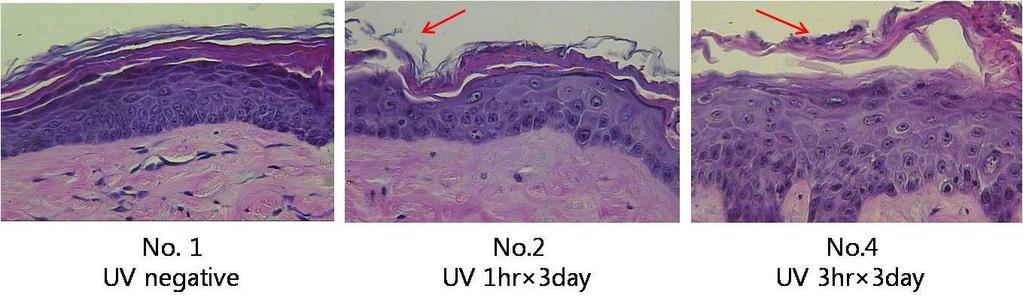 그림 2.1-26. 피부층의단면도. UV 조사에의하여피부의외각상피층의각질화현상에의하여각질층의불균열로층이파 괴되는현상과 다. No.4 의결과에서는각질화현상이심하여떨어져나가는것을확인할수있 그림 2.1-27. 마우스 scruff skin 부분의주름화현상.