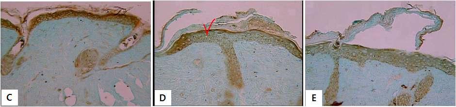 또한 UV-B 하루 1시간씩 3 일노출시킨후, 분획물을처리한결과( 그림 2.1-35), (C) 에서검출되는 MMP3 단백질발현량에비하여 (D) ethyl acetate A 와 (E) ethyl acetate B를처리한표피층에서 MMP3의전체적인발현량은감소하지만정량을하 였을경우 (D) ethyl acetate A 에서그양이현저하게감소하였다.