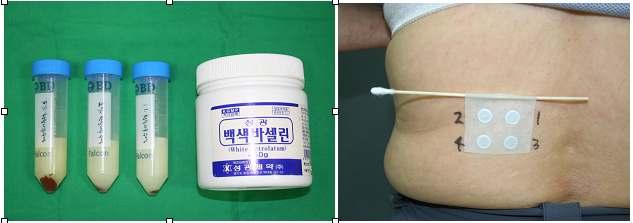 <1. control( 바세린), 2. 1% 희석, 2. 2% 희석, 3. 5% 희석> 그림 4-10. Patch test for excluding irritation reaction of the extracts of Dendrofanax morbifera.