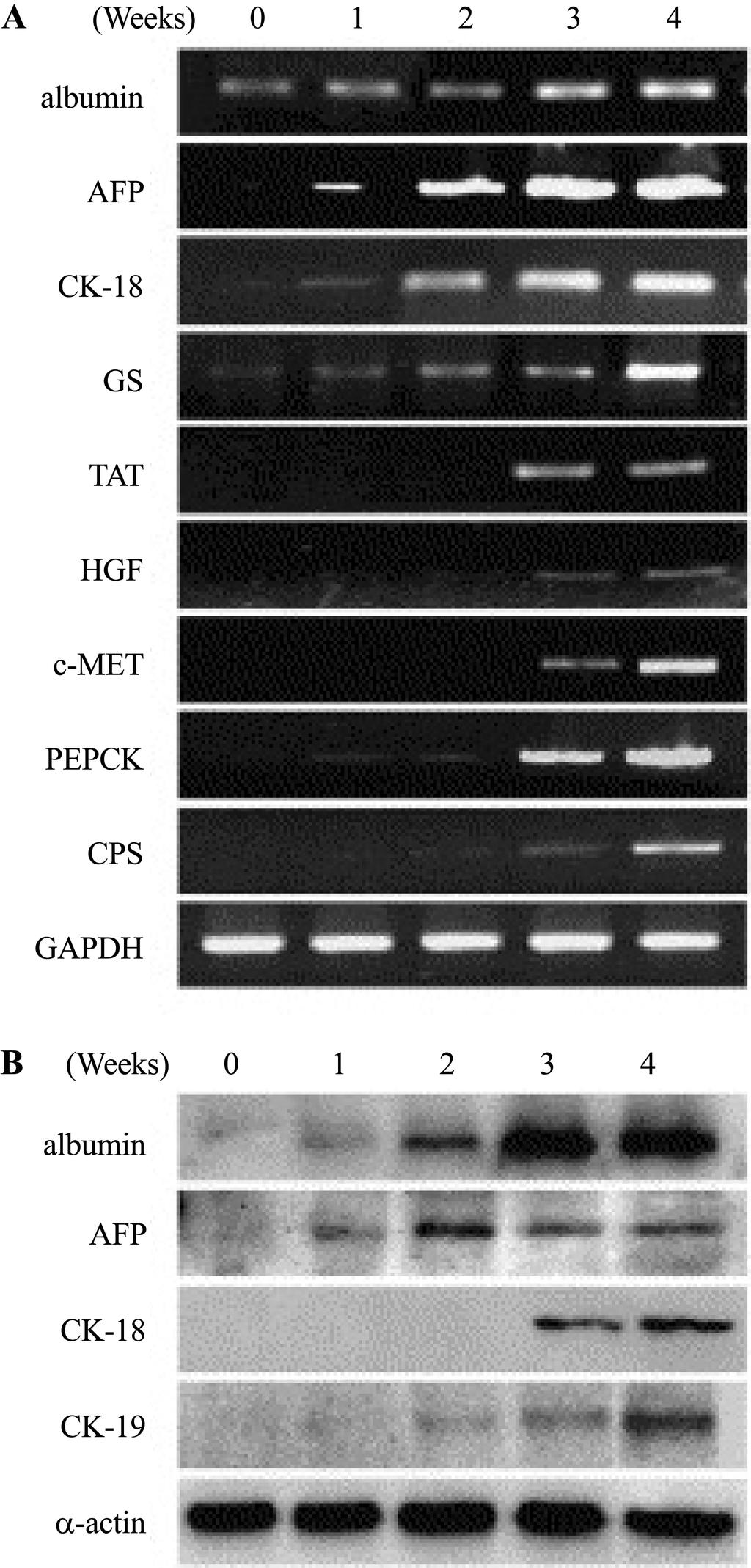 h Œ Œ j 101 Figure 5. RT-PCR and WB analyses of the temporal expression pattern of hepatocyte-specific markers during hepatic differentiation of UCB-derived cells.