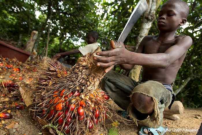 전세계대부분의초콜릿제조업체들이가나와코트디부아르의코코아농장에서코코아를제공받는대요. 코코아를수확해서머리에이고이동을해야해요. 산길은위험해서발을잘못디디면큰부상을입을수있어요.