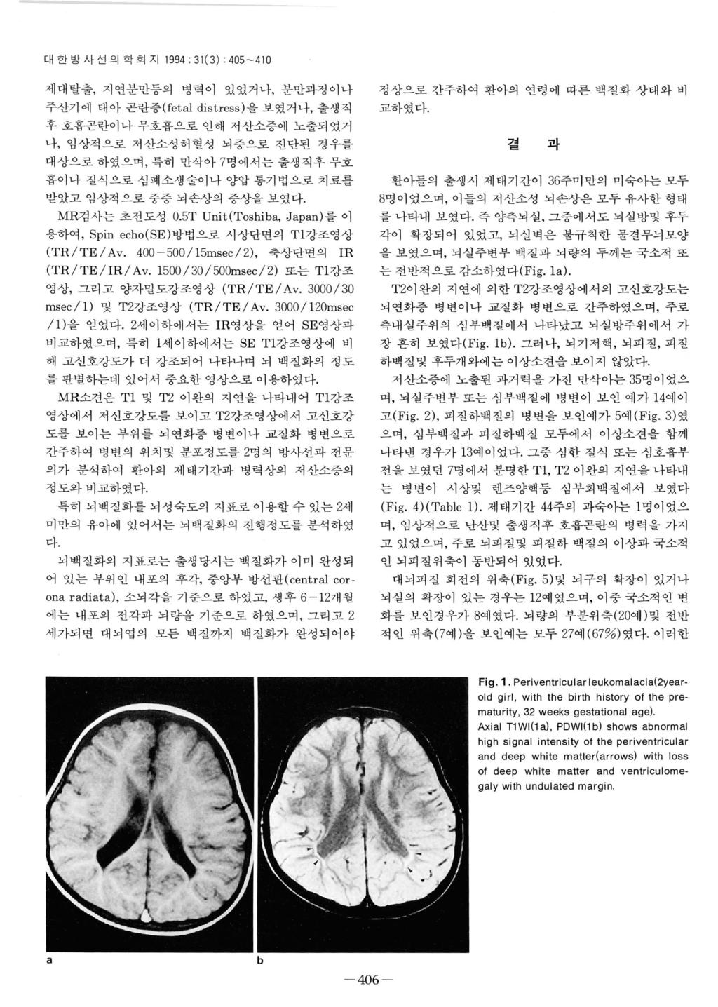 대한방사선의학회지 1994: 31(3) : 405-410 제대탈출, 지연분만등의병력이있었거나, 분만과정이나 정상으로간주하여환아의연령에따른백질화상태와비 주산기에태아곤란증 (feta! distress) 을보였거나, 출생직 교하였다.