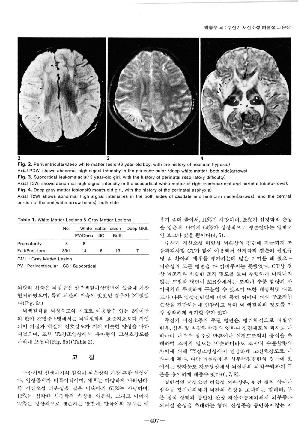 박동우오 1: 주산기저산소성허혈성뇌손상 2 