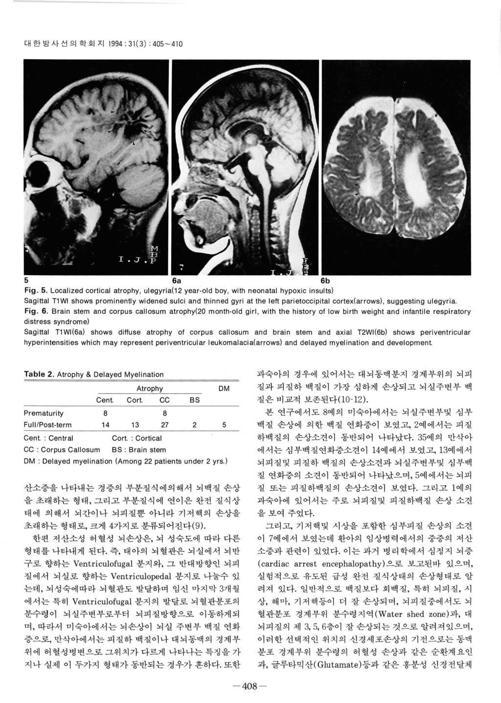 대한방사선의학회지 1994; 31(3) : 405-410 5 