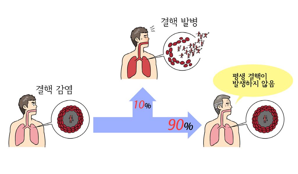 04 결핵균에감염되면모두결핵이발생하지않나요? 잠복결핵감염과결핵은어떻게다른가요? Chapter 1 결핵개요 일반적으로결핵균에감염되면결핵감염후 2년이내에 5% 정도발생하고그이후평생에걸쳐 5% 정도발생하여 10% 정도에서만평생에걸쳐한번정도결핵이발생하는것으로알려져있습니다. 결국결핵에감염된사람의 90% 는평생동안결핵에한번도걸리지않고지내게됩니다.