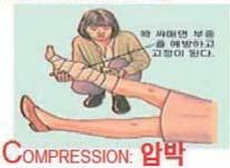 - 개방된상처는부목대기전에깨끗하게드레싱해주고부목은개방상처의반대편에대어준다. - 부목을사용할때는손상받은곳의위 아래의관절을함께고정하여움직이지않도록한다.