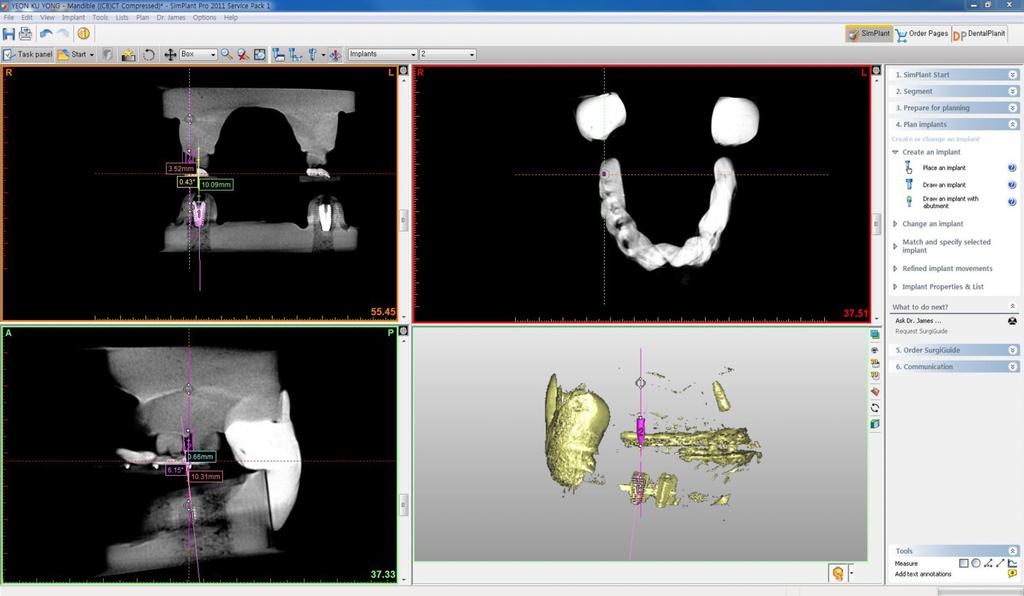 the CBCT image. Fig. 15.