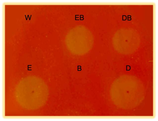 β-glucosidase1 10. 선별되어진효소의고발현벡터시스템의구축및활성확인 : S.