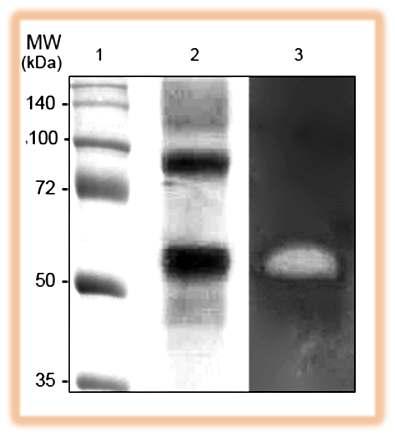 ( 그림 ) EgE, EngD 와 BGL1 의 SDS-PAG E 및 Zymogram 11. 효모형질전환체를이용한바이오에탄올의생산 : 20g/l 의 CMC 를기질로첨가된발효배지에서 30,100rpm 으로배양한결과기존의 S.