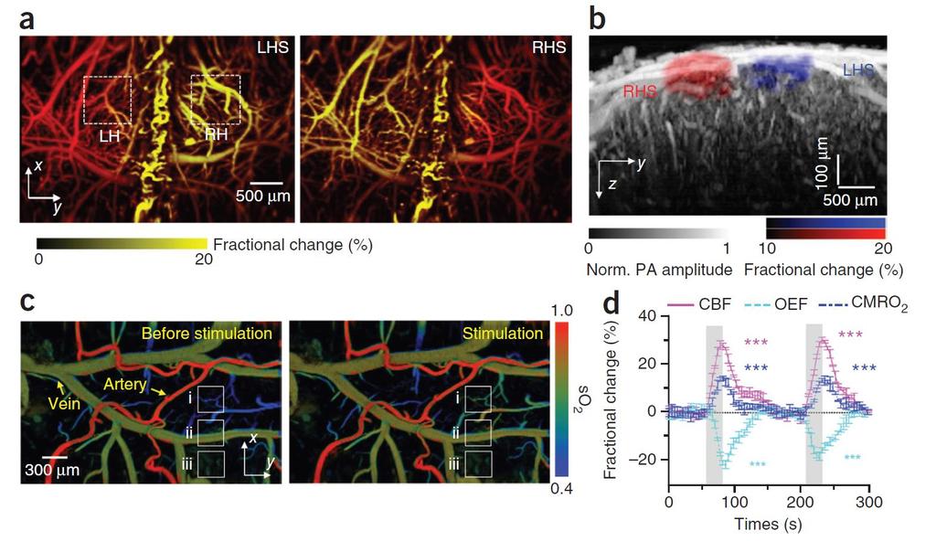 1. 광음향현미경을이용한쥐의뇌이미징법 - PAM of brain responses to