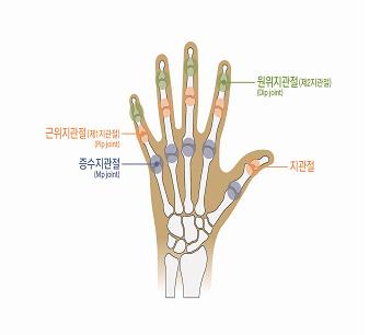 7) 손가락에뚜렷한장해를남긴때 라함은첫째손가락의경우중수지관절또는지관절의굴신 ( 굽히고펴기 ) 운동영역이정상운동영역의 1/2 이하인경우를말하며, 다른네손가락에있어서는제 1, 제 2 지관절의굴신운동영역을합산하여정상운동영역의 1/2 이하이거나중수지관절의굴신 ( 굽히고펴기 ) 운동영역이정상운동영역의 1/2 이하인경우를말한다.