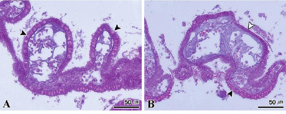 Histopathological feature of digestive gland in sea squirt Halocynthia roretzi by the effect of starvation. A: 8±.. B: ±.. Fig.