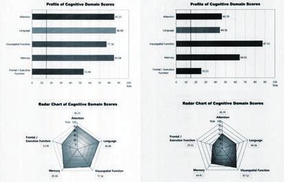 Topic Review ㅣ뇌신경센터차의과학대학교분당차병원 03 rhinalcortex) 이나해마 (hippocampus) 와같은기억과관련된뇌조직의위축이 SMI에서도관찰되는것은 SMI가경도인지장애나치매로발전될가능성을시사한다. 한메타분석연구에서 SMI가있는사람들이그렇지않은사람에비해치매로발전할가능성이 2배가량높으며, 연간 6.6% 가 MCI로, 2.