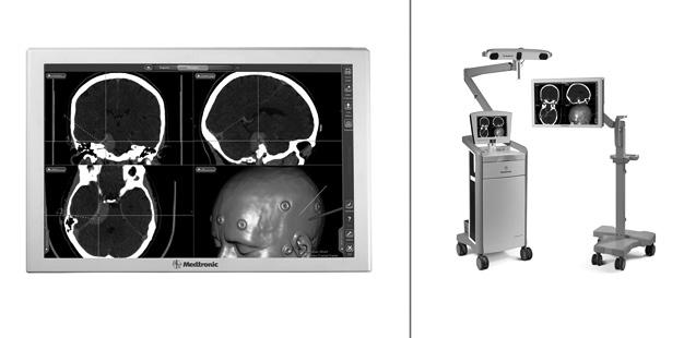 최근에개별영상기기의장점만을부각하여융합되는 PET- CT, PET-MRI 등에서영상진단기기개발에있어서대용량의영상을빠르게처리하기위해속도개선과동일환자에게서얻은서로다른영상의좌표를일치시키는영상정합기술은필수이다. 중재시술이나수술용치료기기에서영상진단기기는영상의정합뿐만아니라 3D 정보를이용하여수술자를가이드해주는네비게이션기술적용으로보다향상된치료효과를나타내고있다.