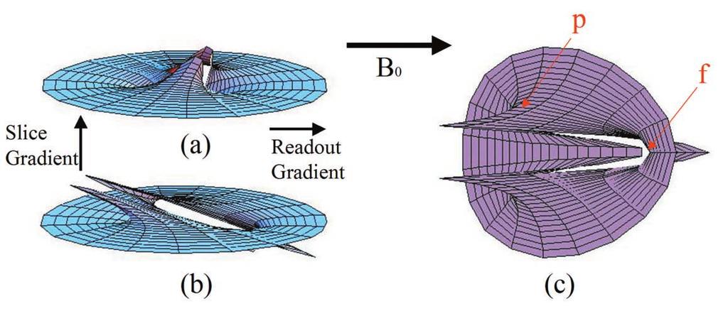 Determining the Location of Metallic Needle from MR Images Distorted by Susceptibility Difference function of susceptibility χ, as follows: μ=1+χ.